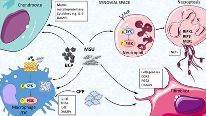 Frontiers Disease Associated Particulates And Joint Inflammation