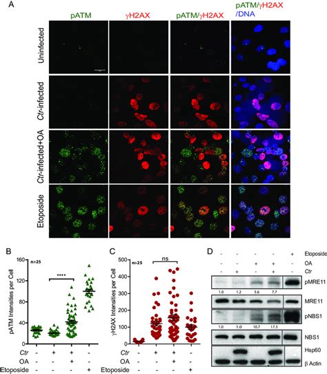 Upon PP2A Inhibition Activated ATM Recruits Partially To DSBs And