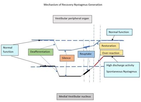 Brain Sciences Free Full Text Recovery Nystagmus In Vestibular Neuritis With Minimal Canal