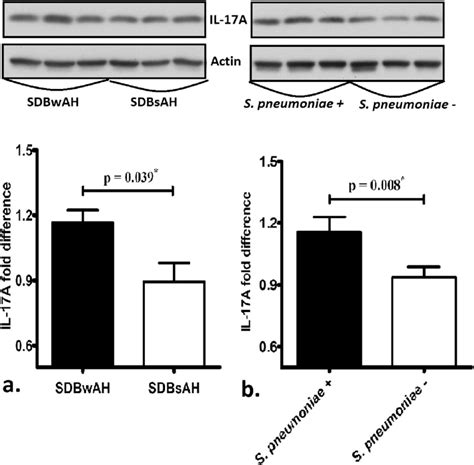 Protein Quantification By Western Blot Confirmed Result Of Mrna