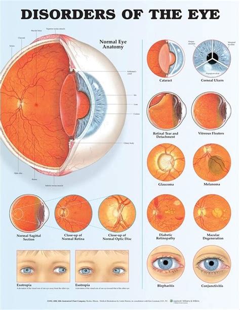 Treatment And Management Of Ocular Disease Hodes Vision Optometry