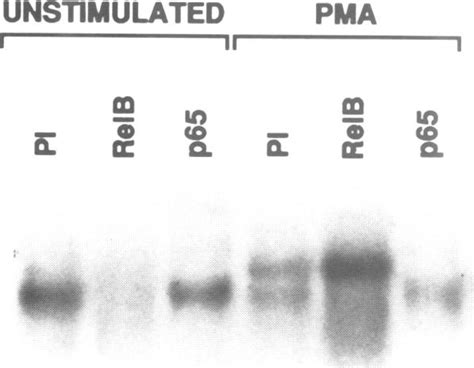 Analysis Of Rel Nf Kb Binding Activity In Daudi Cells Whole Cell