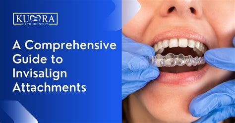 A Comprehensive Guide to Invisalign Attachments | Kumra Orthodontics