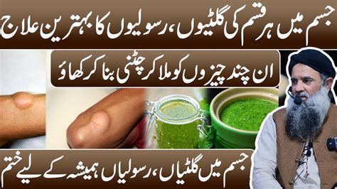 Gilti Ka Treatment Gilti Ka Ilaj In Urdu Rasoli Khatam Karne Ka