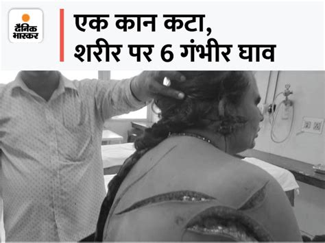 When The Woman Caught Dabang Attacked The Whole Body With A Hammer The Woman Got 175 Stitches