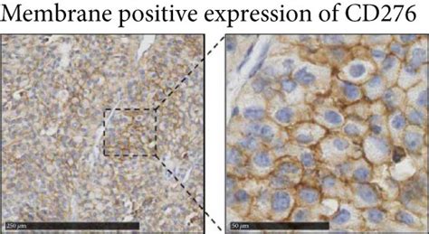 Differential Cd276 Expression In Adrenocortical Carcinoma A Download Scientific Diagram