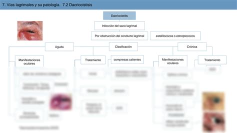 SOLUTION V As Lagrimales Y Su Patolog A Studypool