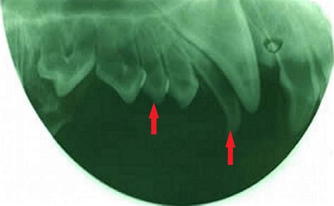 Congenital And Inherited Anomalies Of The Teeth In Animals Digestive