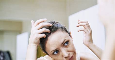 Simple Ways To Get Rid Of Dandruff