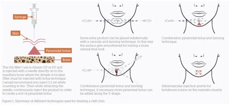 Exercises To Get Rid Of A Cleft Chin Online Degrees