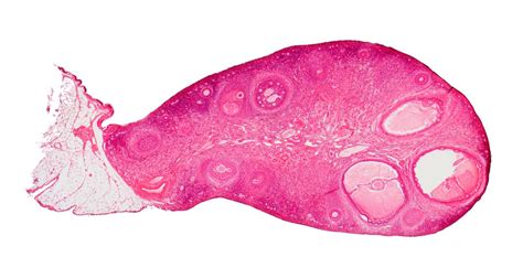 Ovary cross-section | Smithsonian Photo Contest | Smithsonian Magazine