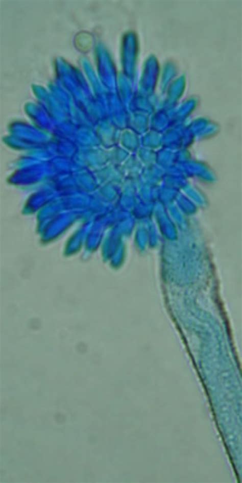 A. flavus Archives - Aspergillus and Aspergillosis