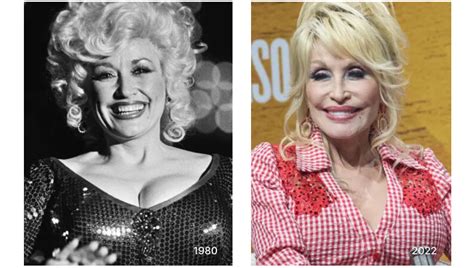 Dolly Parton Before And After Weight Loss