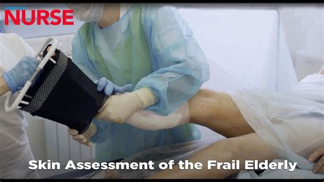 Skin Assessment Of The Frail Elderly Youtube