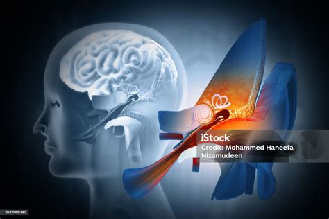 The Anatomical Structure Of The Human Ear Sound Wave And Ear With Middle Ear Otitis Auditory