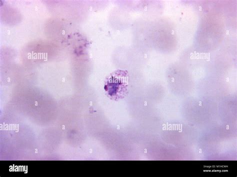 Microfotografía De Los Parásitos Causantes De La Malaria Plasmodium Vivax En Su Forma Schizont