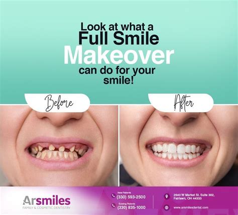 Smile Makeover Cosmetic Dentistry Dentistry Smile Makeover