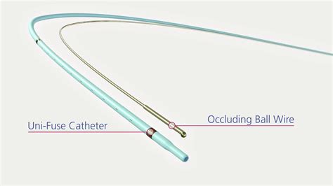 Uni Fuse Infusion Catheter Animation Youtube