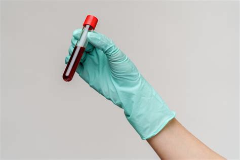 Premium Photo Hand In Latex Glove Holding Blood In Test Tube Close Up