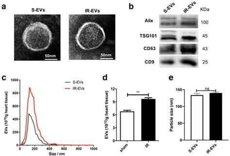 Characterization Of Cardiac Evs A A Representative Tem Image Of