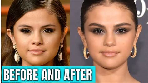 Selena Gomez Plastic Surgery 2020 And Beauty Youtube