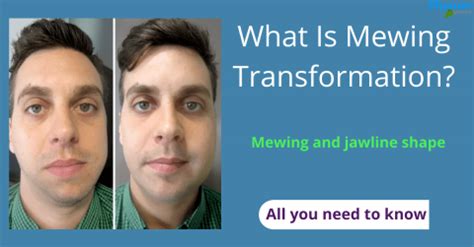 What is mewing transformation?