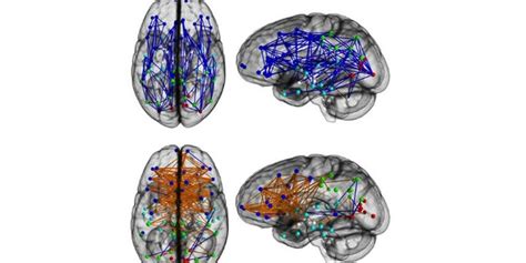 How Mens Brains Are Wired Differently Than Womens Fox News