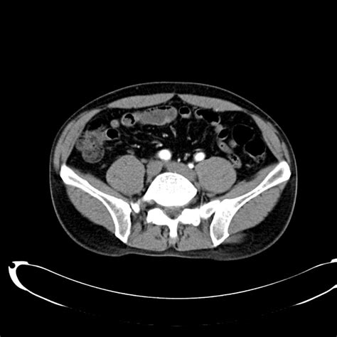 A Systematic Approach to the Interpretation of CT Abdomen/Pelvis