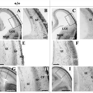 Calbindin Expression In Wild Type Wt And Pax Mutant Mice At