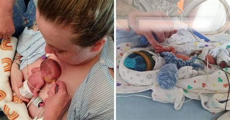 premature baby born   weeks    thriving  year
