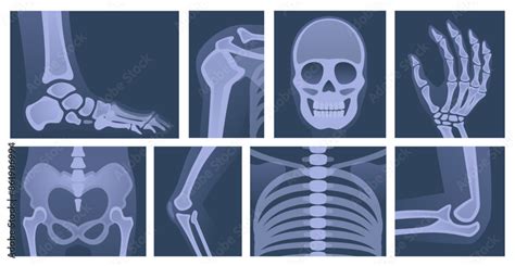 Human Skeleton X Ray Body Parts Skull Bones Of Arms Knee And Legs