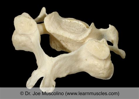 Cervical Vertebrae - Learn Muscles