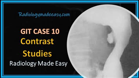 Frcr Radiology Git Contrast Case 10 A 65 Yrs Old Patient Presented