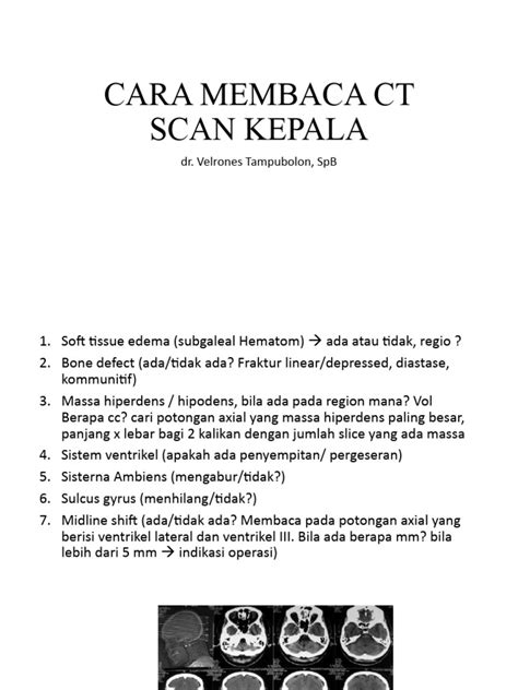 Cara Membaca Ct Scan Kepala Pdf