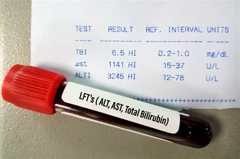 Bilirubin Levels: Normal Values, High Causes, and Tests | Bowtie
