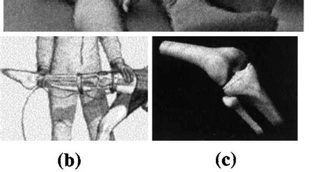 (a) The VRDA tool will allow superimposition of virtual anatomy on a... | Download Scientific ...