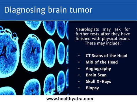 Brain Tumor: Causes, Risk Factors & Diagnosis - Updated 2024