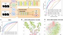 Detecting Schizophrenia With D Structural Brain Mri Using Deep