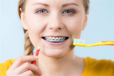 How to Brush Teeth with Braces: What You Should Know