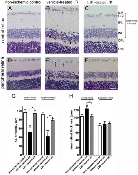 Af Representative Photomicrographs Of H E Stained Retinal Sections