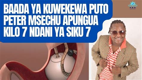 Msechu Apungua Kilo Saba Siku Saba Tu Baada Ya Kuwekewa Puto Kupunguza