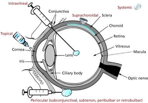 Ocular Drug Delivery System Pharmanotes