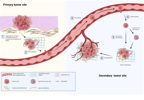 Tumor Metastatic Cascade Biorender Science Templates