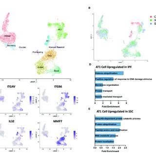 Scrna Seq Analysis Of Ipf Ssc Ild And Control Epithelial Cell