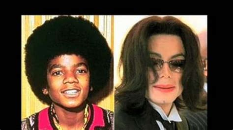 Michael Jackson Nose Collapse