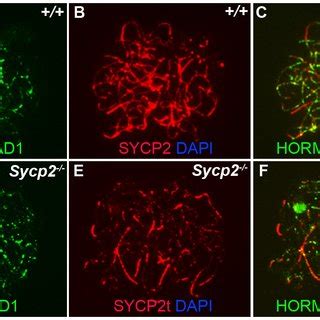 Hormad Localization In Sycp Mutant Spermatocytes Chromosome Spread