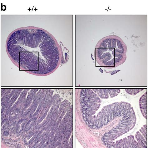 Ets Th Cells Do Not Induce Colitis In Scid Mice Scid Mice Were