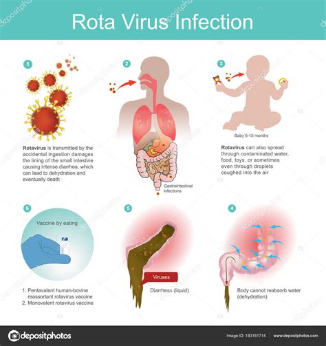 O Rotav Rus Transmitido Pela Ingest O Acidental Vetor De Stock De