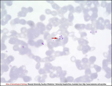 Plasmodium Malariae Cell Atlas Of Haematological Cytology