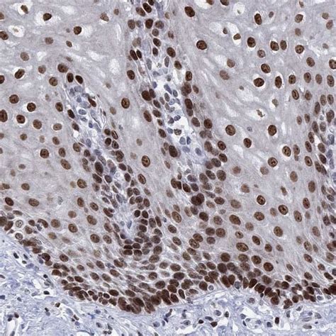 HMGA1 Antibody Novus Biologicals 25 μg Unconjugated Antibodies